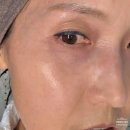 (주)순수자연건강 | 민감성 피부 팔자주름관리 팔주크림으로 완성하는 바르는 팔자주름패치 홈케어