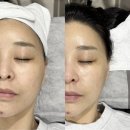 (주)정인앤비전 | 대전피부관리 잘하는 에이아이앤비뷰티에서 수분진정관리 후기