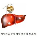 간암 항암치료 중의 식사 관리와 보조적 요법 이미지