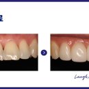 미니쉬치과기공소 이미지