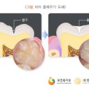 친절한임치과 네이버블로그