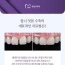 하우치아
