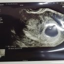 동서연산부인과의원 네이버블로그