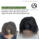 오직 스칼프 | 미사두피문신으로 자신감을 되찾은 트렌디스칼프 후기