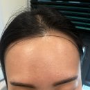 리타헤어 - 서대문구 | [경기/남양주] 리타임뷰티(러보브뷰티) 다산점에서 M자 이마 헤어라인 후기