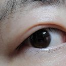 서울베스트안과의원 이미지