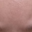 건대톡스앤필의원 이미지