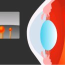 밝은눈안경원 이미지