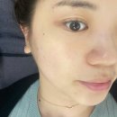 W_ 광주 피부관리 &#39;르헤브스킨케어&#39; 2회차 슈라멕 그린필
