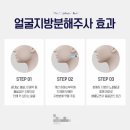 압구정 성형외과 셀인아웃주사 쥬베룩 볼륨 / 남편 첫 피부시술 후기