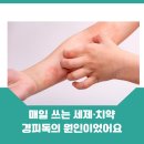 온가드 | 경피독이 뭐길래? 우리 아이 피부에 닿는 것부터 바꾼 이야기 도테라 온가드
