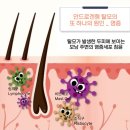 홍대탈모, 염증을 다스려야 탈모가 좋아진다? (+열 많은 남자의 탈모치료 후기)