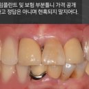 더서울치과 네이버블로그