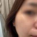 비비안나 | [강서에스테틱] 메이크업비비안나 피부관리 플라즈마 후기