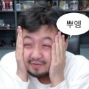 분당교정치과 성인 치아교정 비용, 후기 (4개월)