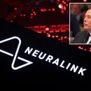 일론 머스크의 Neuralink, 로봇팔을 이용한 새로운 뇌 이식 실험 시작 이미지