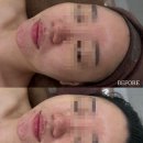 라미엘 | 양산서창피부관리 추천✨ 1인샵 라미엘뷰티&왁싱에서 받은 물방울리프팅 리얼후기
