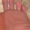 핵심목욕탕 | 라미실원스 사용법, 가격, 후기 총정리! 한 번 바르면 끝? 무좀약 꿀팁 모음