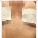 평택피부관리샵 에스제이 파메스테틱에서 피부회복시간 가졌어요