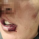 데이트폭행 목격 신고자 경찰과 다두타 체포당해 전치 4주 ㄷㄷ 이미지