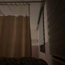 스머프PC | 무서워 할 사람들을 위해 20대 망막박리 '공막동률술' 수술후기