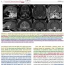 신경계를 포함하는 lymphoma가 있는 고양이에서 임상적 &amp; MRI features 이미지