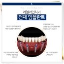 조아치과 네이버블로그