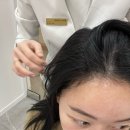 안가마실천 | 평택 두피관리 웰킨 평택점 파워 디톡스 관리 받고 온 후기 (feat.지성 탈모형)