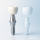 ㈜고려덴탈 이미지