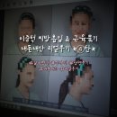 제이앤씨파트너스모든머리 | 근육묶기 내돈내산 *4탄* (4개월 차 / 흉터, 바이오본드, 목주름) 아낌없이 보여드릴게요! 솔직후기!