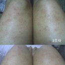 에버노블 이미지