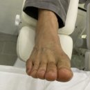 연수동산로 | 충주내성발톱 충주발관리 바미네일 레푸스 충주연수점 문제성 발톱 케어 후기