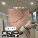 블리홍