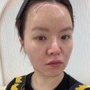 40 | 서울 강남 창원 엘라비에 리투오 40대 후기 전후 비교 리얼 변화