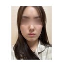 대전 피부관리 내돈내산 후기, 미쁘다 ( 여드름, 흉터 관리 )