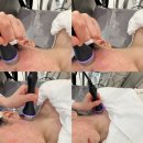 동작(1) | [서울/동작] 서울 동작 인더뷰티 여드름 관리 후기 1