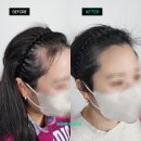 도트자산관리 | 대전smp두피문신 가격 내고 백프로 손해 보는 '유형'은?