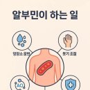 에스오디미네랄의원내 | 2026년 대세 영양제 알부민, 정말 효과 있을까? 의학적 진실과 현명한 섭취 가이드