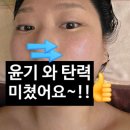 탑셀바이오뱅크 | [구서동 피부관리실] 타조오일 윤곽관리 대박! 닥터힐럭스 뷰티뱅크 구서점 찐후기 ✨