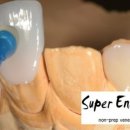 종래슈퍼 이미지