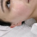 [서울] 아이린뷰티&amp;아카데미 성북점 : 스킨플래닝과 스킨업 받고 온 후기 / 물광피부관리 원한다면 추천