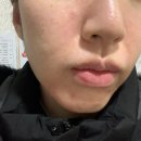 뷔에고 | 김포운양동 피부관리 뷔에고에스테틱 네오더마 바이오필링 (비건/임산부 가능 필링)