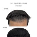 제이린헤어 - 전주시 완산구 세내로 291 | 부산탈모 부산탈모관리 믿고 맡기는 제이린SMP