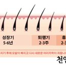 탈모케어존
