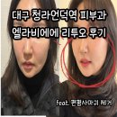 청라언덕역(2대) | 대구 리투오 신상 스킨부스터 청라언덕역 피부과 내돈내산 솔직후기