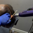 명포차 | 망포역두피관리 추천! 올리다두피탈모전문센터 가서 부모님께 효도하고 온 후기