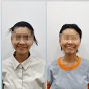 천호한의원 | [천호] 안면비대칭한의원에서 교정한 후기 (feat. 안면비대칭교정가격)