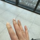 손끝이 하얗게 돼버렸다. 레이노증후군.. 혹시 전신경화증?
