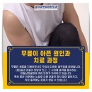 서04-422 | 대구무릎수술, 발병 원인과 치료 과정