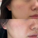 덕천초등학교 | 안양 피부관리 엘가비에스테틱 안양범계점